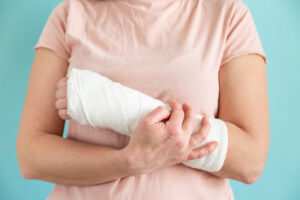 a person with a cast on their arm